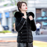 Removable Cap Down Cotton Small Padded Jacket